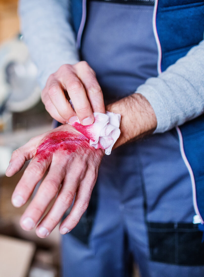 Cut & Lacerations Claims